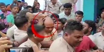 नकली बाल लगाकर दूल्हा पहुंचा शादी रचाने, ऐसे खुली पोल, जमकर हुआ हंगामा…लड़की वालों ने जूते से की खातिरदारी