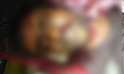 मानसिक तनाव में युवक ने खुद का गला रेतकर की आत्महत्या, अस्पताल में हुआ मृत घोषित