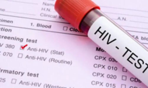 CG – छत्तीसगढ़ के इस जिले में डरा रहा एचआईवी संक्रमण का आंकड़ा, 6 महीने में इतने नए केस आए सामने…